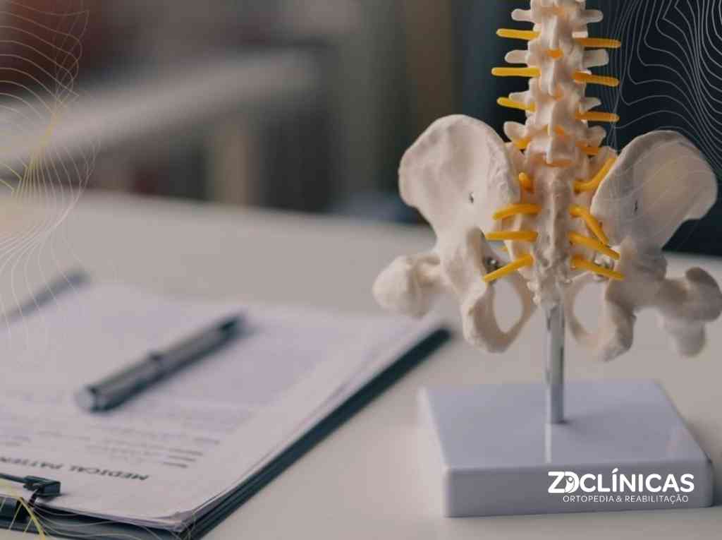 Osteoporose: o que é, fatores de risco e como tratar a perda de massa óssea